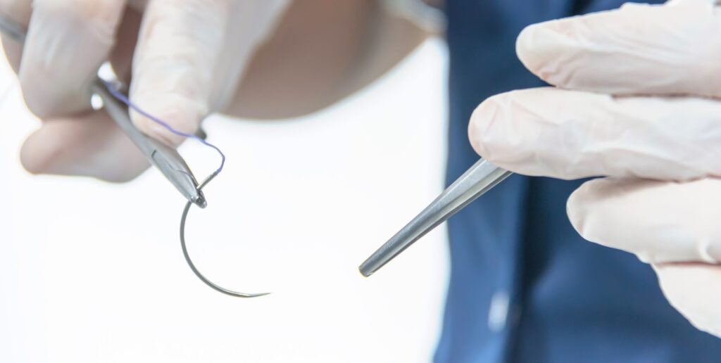 Cirujano sosteniendo instrumentos de cirugía para realizar una sutura quirúrgica